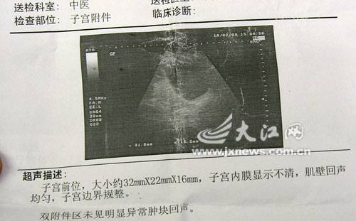 ҽԺ��С�ο��ߵļ�鵥